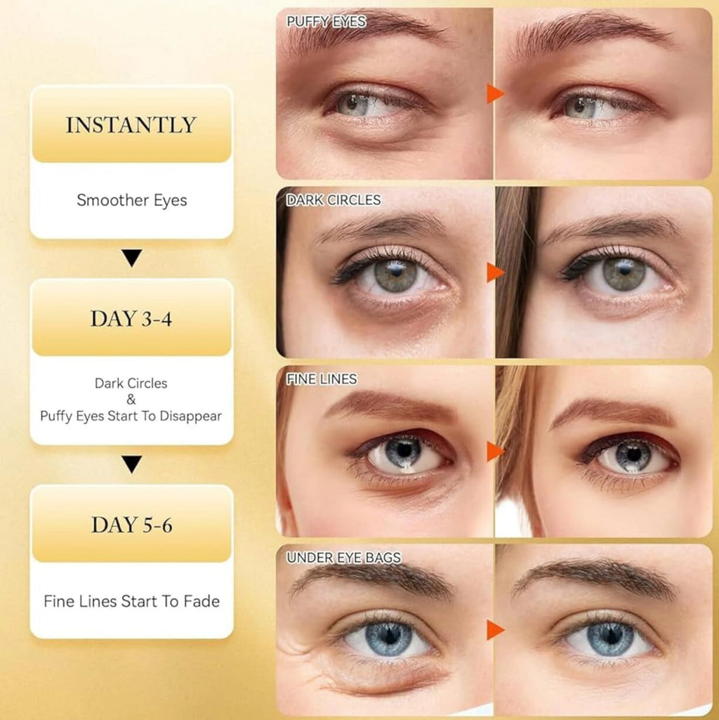 24K Gold Hydrogel Under Eye Patches – Dark Circles & Puffiness Relief